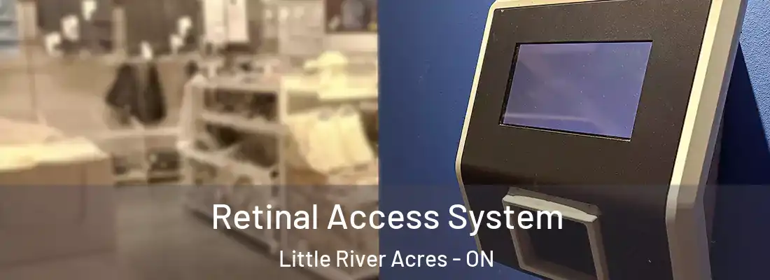  Retinal Access System Little River Acres - ON