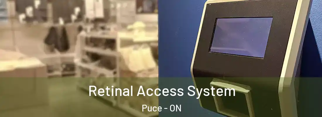  Retinal Access System Puce - ON