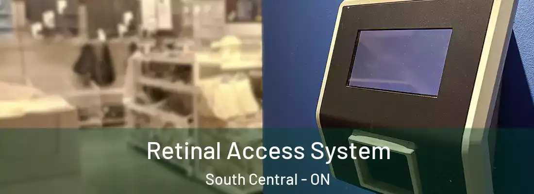  Retinal Access System South Central - ON