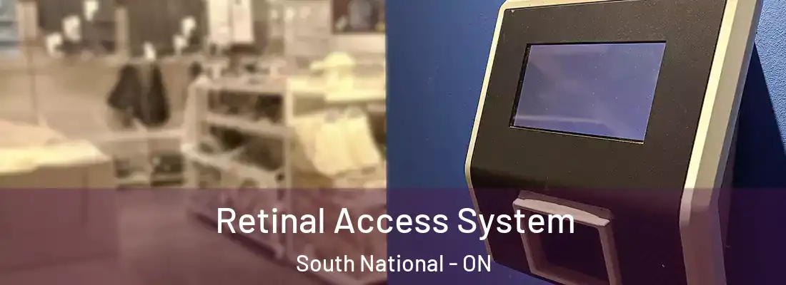  Retinal Access System South National - ON